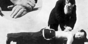 Chiropractic & it’s History